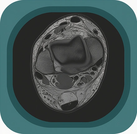 MRI ankle ligaments anatomy icon